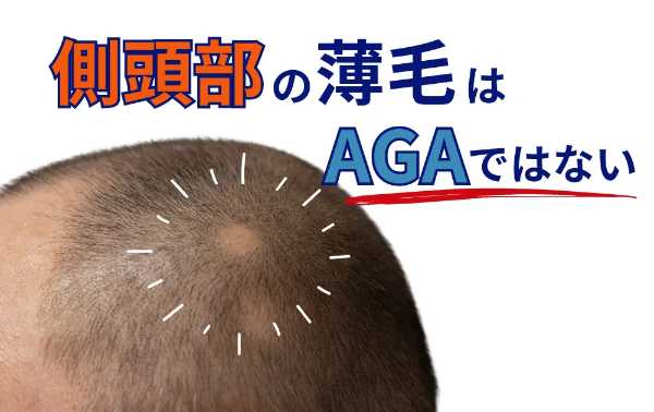 記事サムネイル