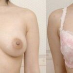 レス2番の画像7