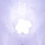 レス2番の画像3