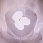 レス2番の画像4